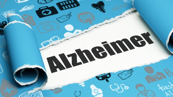 Alzheimer