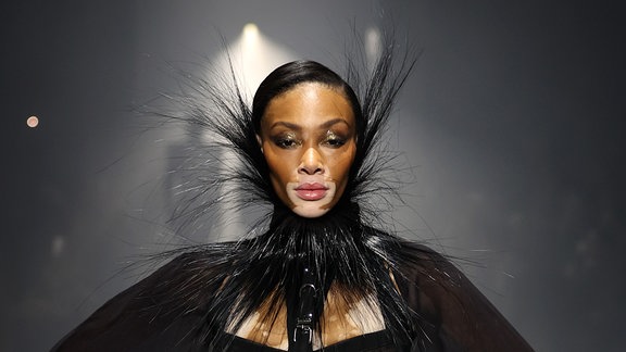 Winnie Harlow