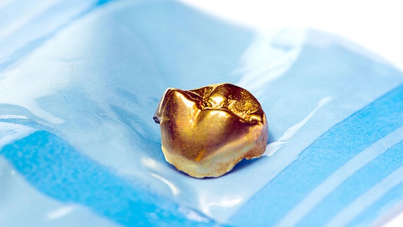 Ein Gold-Inlay, auf einer Folientüte liegend