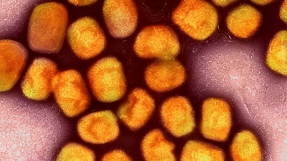 Eine kolorierte transmissionselektronenmikroskopische Aufnahme von Partikeln des Affenpockenvirus (Gold), kultiviert und gereinigt aus einer Zellkultur, aufgenommen in der NIAID Integrated Research Facility, veröffentlicht am 26. Juli 2022, in Fort Detrick, Maryland.