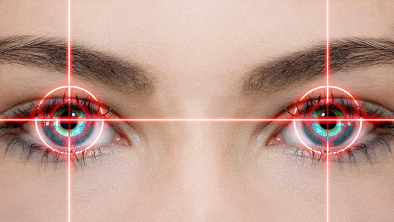 Augenlaser