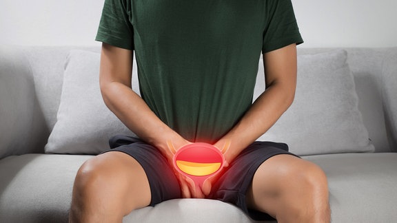 Ein Mann sitzt auf einem Sofa und hält beide Hände zwischen den Beinen. Fotomontage einer schematischen Darstellung der Blase davor.