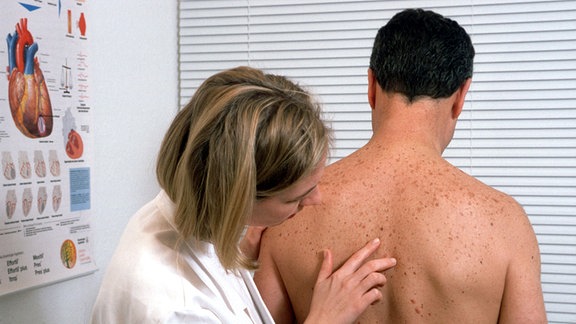 Eine Dermatologin untersucht den Rücken eines Mannes auf Hautveränderungen.