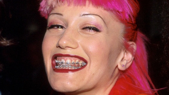 Gwen Stefani mit Zahnspange