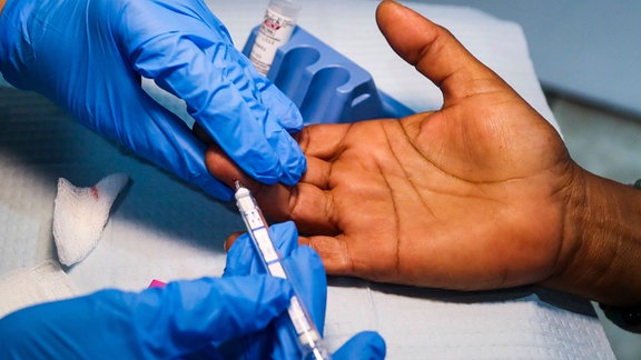 Frau wird in den Finger gestochen, als sie auf HIV und Hepatitis C getestet wird.