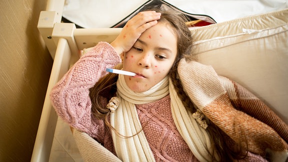 Mädchen mit Windpoken hält Fieberthermometer im Mund