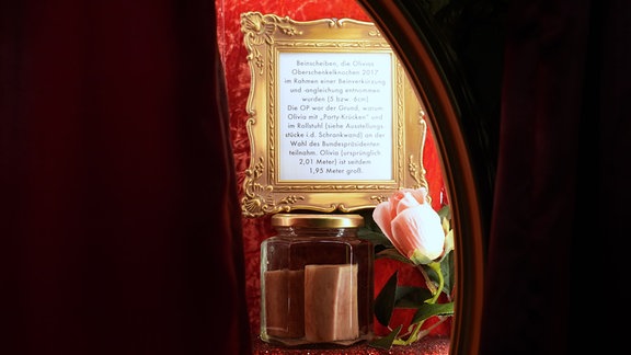 Die Beinscheiben von Dragqueen Olivia Jones, die sie sich bei einer Beinverkürzung aus dem Oberschenkelknochen entnehmen ließ, steht in einem Weckglas in einer Vitrine im Kostümfundus in der Olivia Jones Bar in der Großen Freiheit auf St. Pauli. 