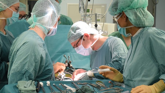 Im Transplantationszentrum am Universitätsklinikum wird eine von einem gesunden Spender vor wenigen Minuten entnommene Niere beim Empfänger transplantiert. 