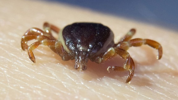 Eine tote Zecke Hyalomma marginatum sitzt in der Parasitologie der Universität Hohenheim auf der Hand einer Doktorandin. 