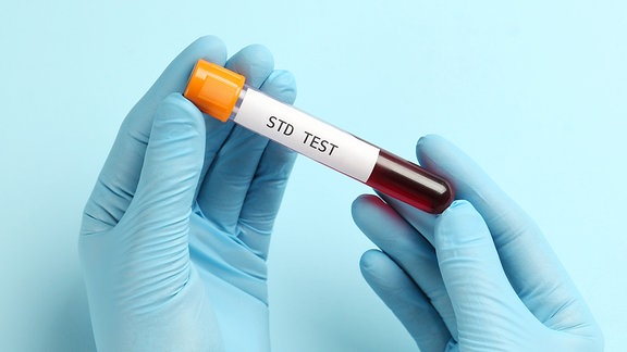 Röhrchen mit Blutprobe und Etikett STD Test