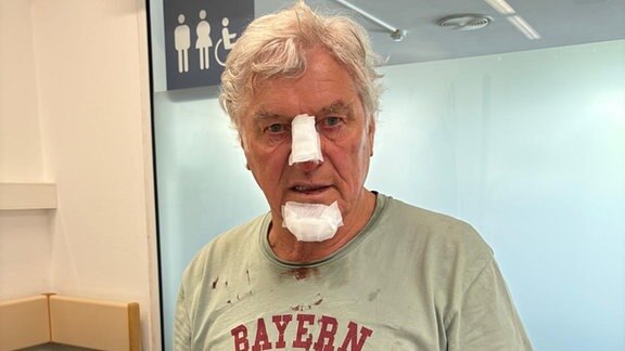 Michael Hartl mit versorgten Verletzungen im Gesicht.