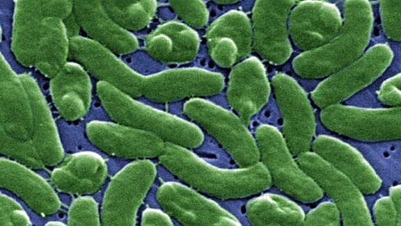 Vibrio vulnificus